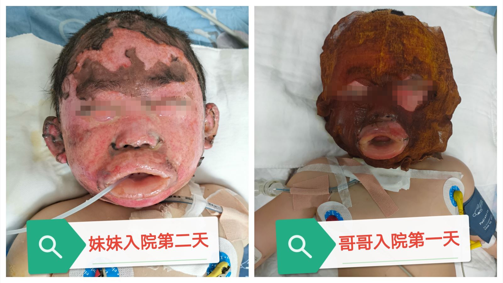 盘锦供卵试管婴儿医院