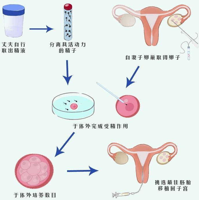 供卵做试管婴儿的适应症有哪些辽宁盘锦龙凤胎供卵做试管婴儿多少钱