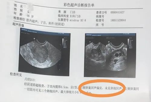 借精试管婴儿后的饮食和注意事项