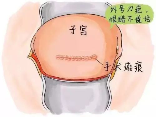 有基因易位的男性做供卵助孕代怀机构有用吗？