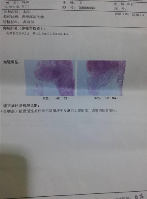 最新的女性激素正常值六项参考表出来了，雌二醇、睾酮都有
