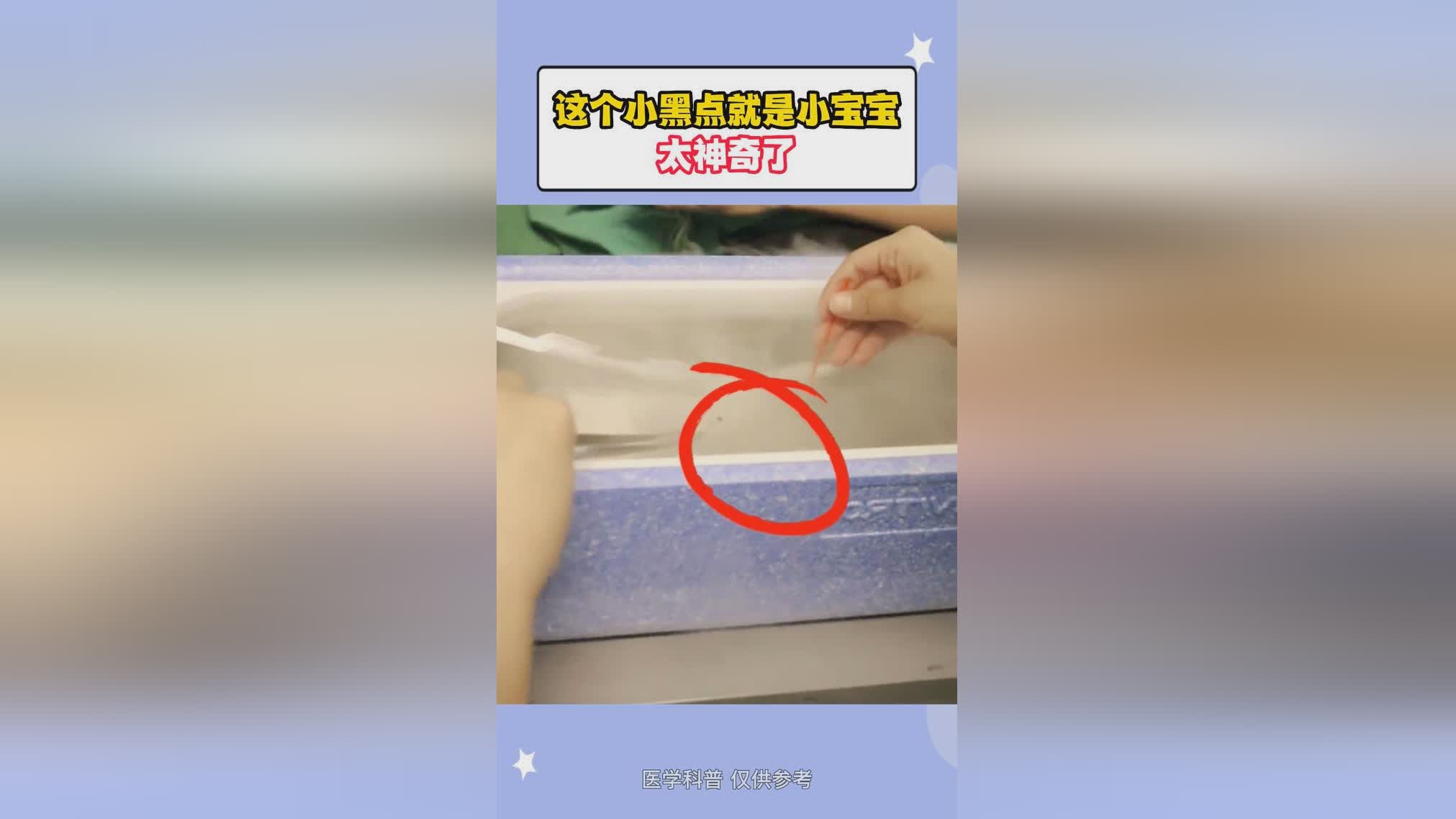 有巧克力囊肿可以做赠卵试管哪里自怀吗？