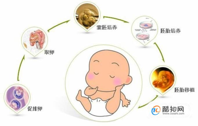 借卵做试管婴儿取卵后什么时候受精