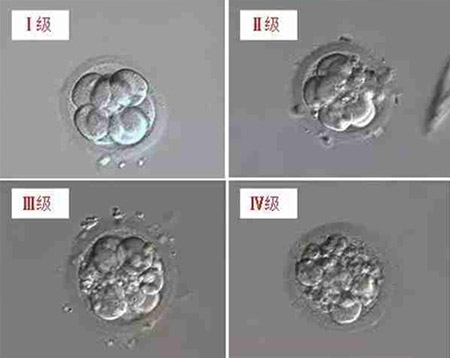 辽宁医院借卵做试管婴儿成功率