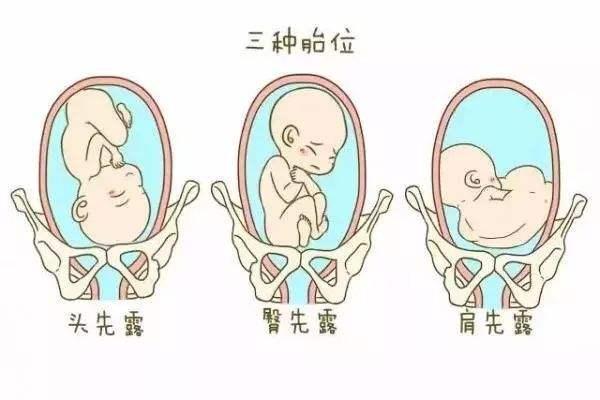 试管婴儿植入受精卵个数有规定吗