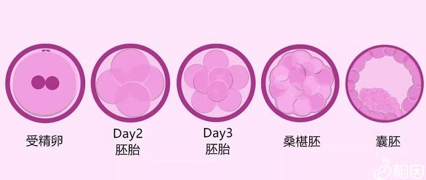 试管需要多少钱一次