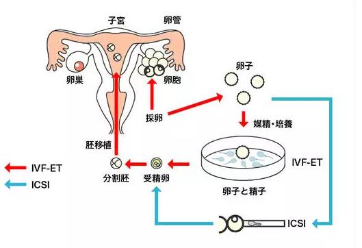 沈阳做试管哪家好