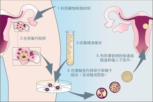 辽宁沈阳妇儿医院试管婴儿