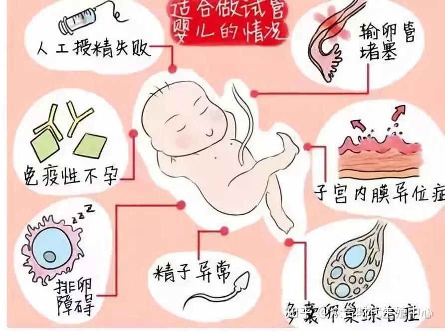 做试管婴儿女方年龄是多少