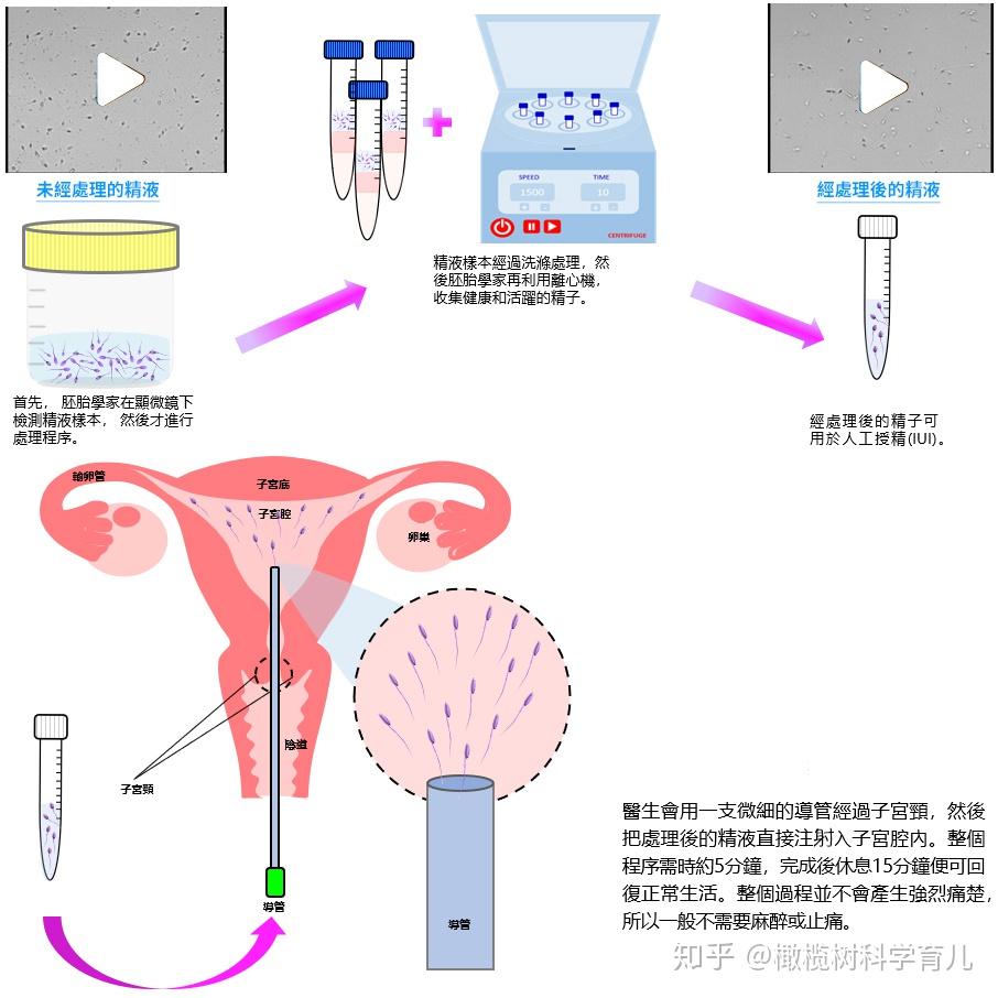试管移植成功怀孕三个月稳定了吗