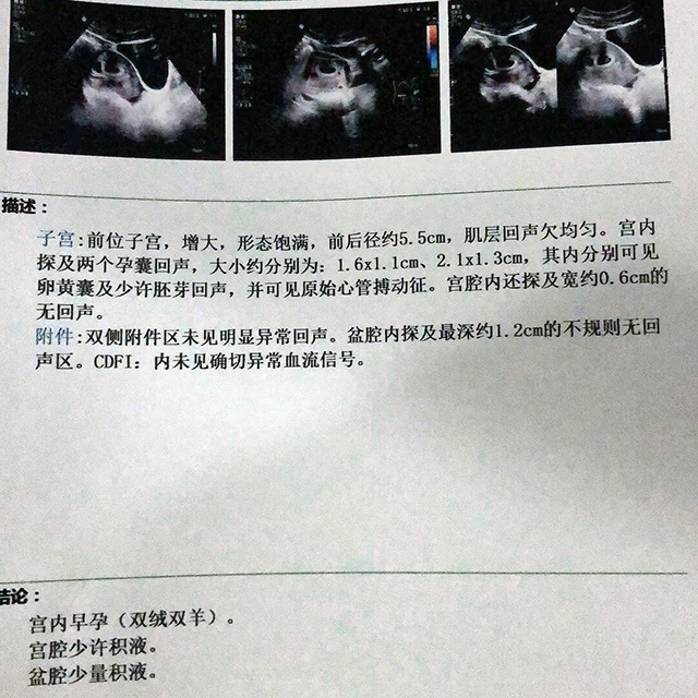 如何才能保养子宫内膜的健康为试管移植准备？