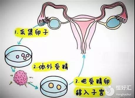 沈阳试管代生孩子多少钱最好医院排名？附成功率及医院名单？