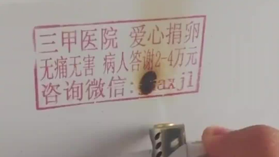 试管反复不成功查免疫全套项目要准