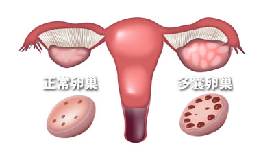 在辽宁沈阳靠谱代生孩子中介婴儿胚胎移植的操作过程是怎样的+