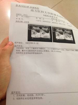 52岁卵巢储备功能差,只有两个卵泡能试管吗
