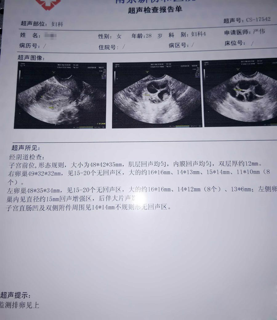 供卵怀孕公司促排期间高蛋白不能这样补