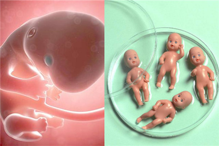 2024年2024北医三院助孕代怀生子费用婴儿的费用明细是怎样的（内附试管费用明细）