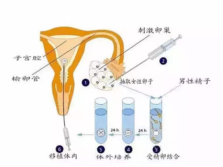 辽宁沈阳沈阳包生代生代怀男宝儿子_辽宁排卵障碍如何检查